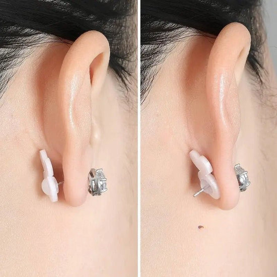 Elanti - Instant Fix for Drooping Earrings (2+3 Free)